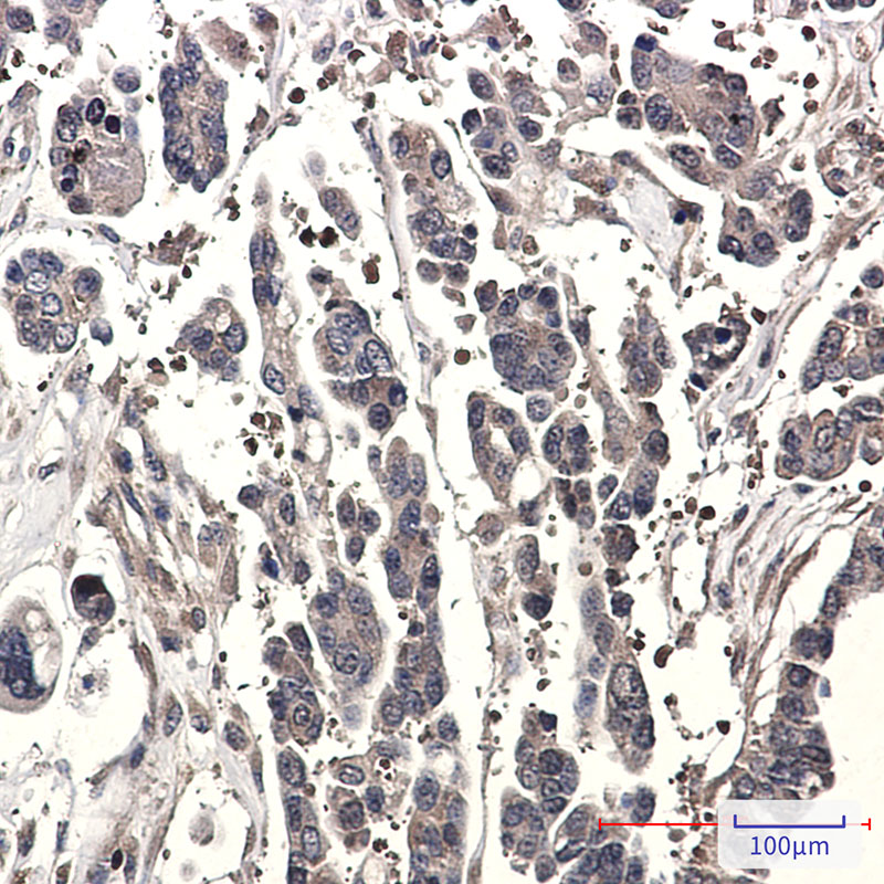 Rabbit Monoclonal Antibody to SPAK