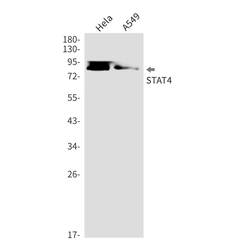STAT4