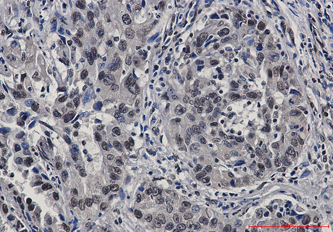 Rabbit Monoclonal Antibody to STAT4