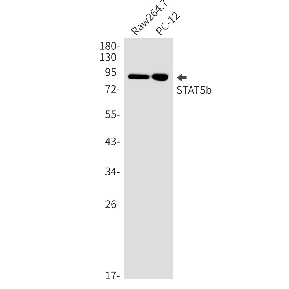 STAT5b