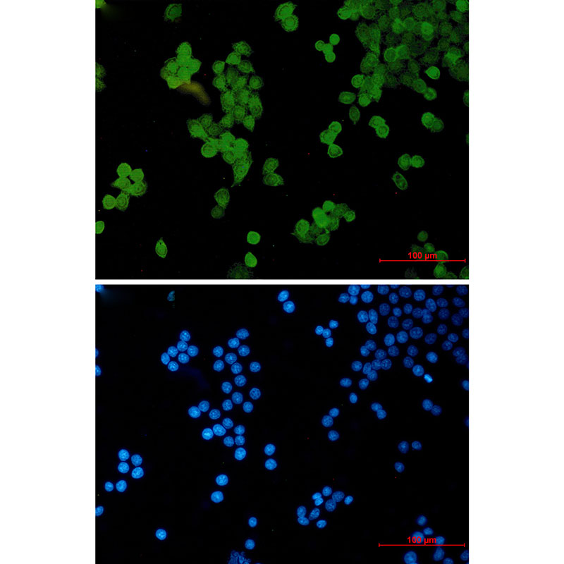 Rabbit Monoclonal Antibody to STAT5b