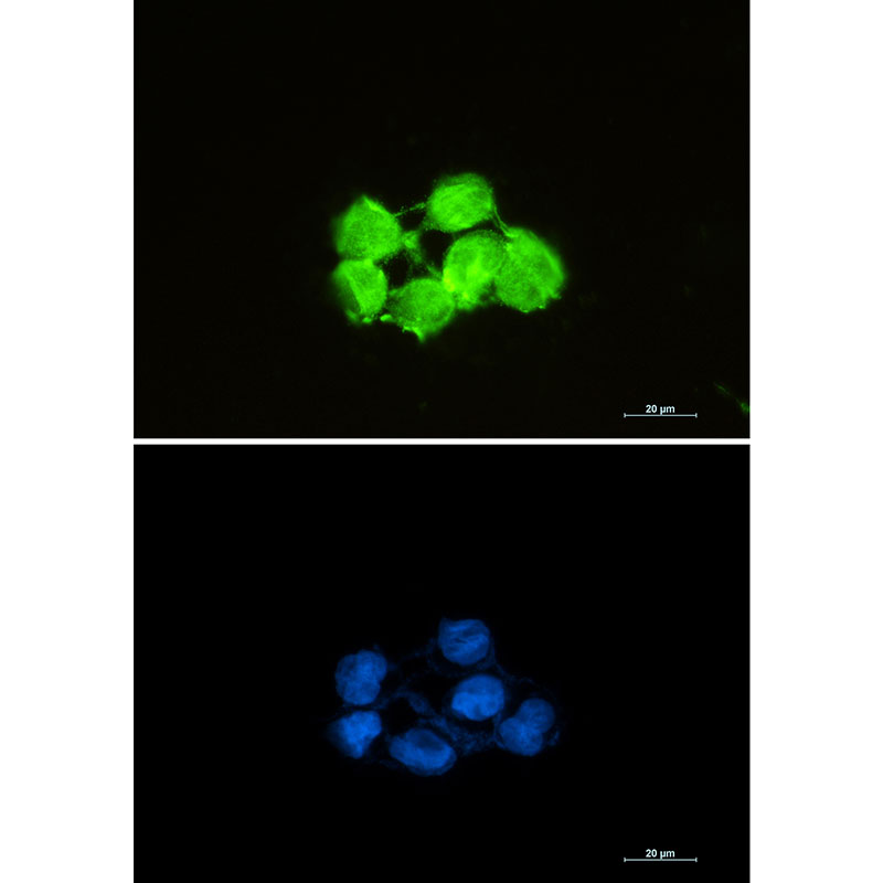 Rabbit Monoclonal Antibody to Superoxide Dismutase 1