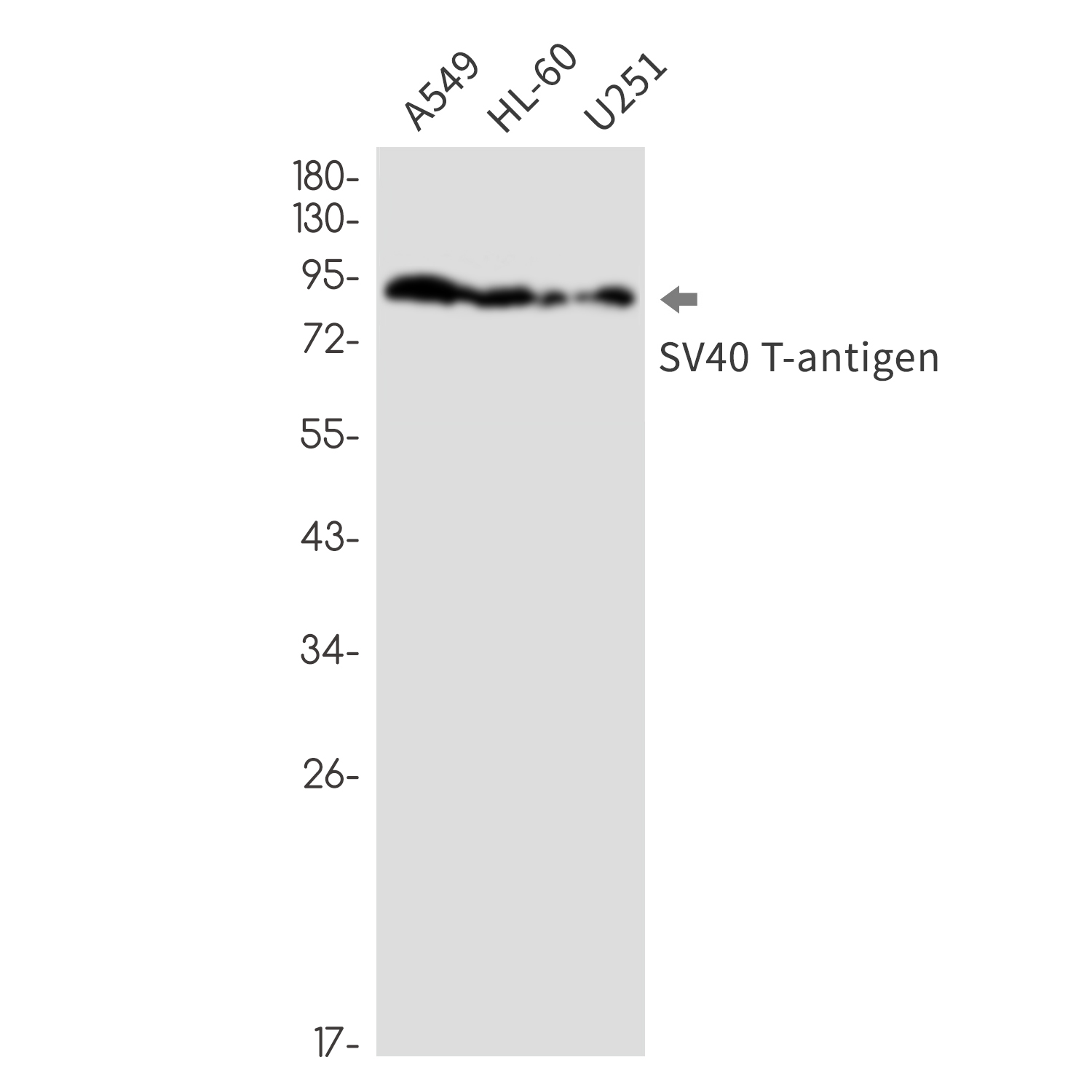 SV40 T Antigen