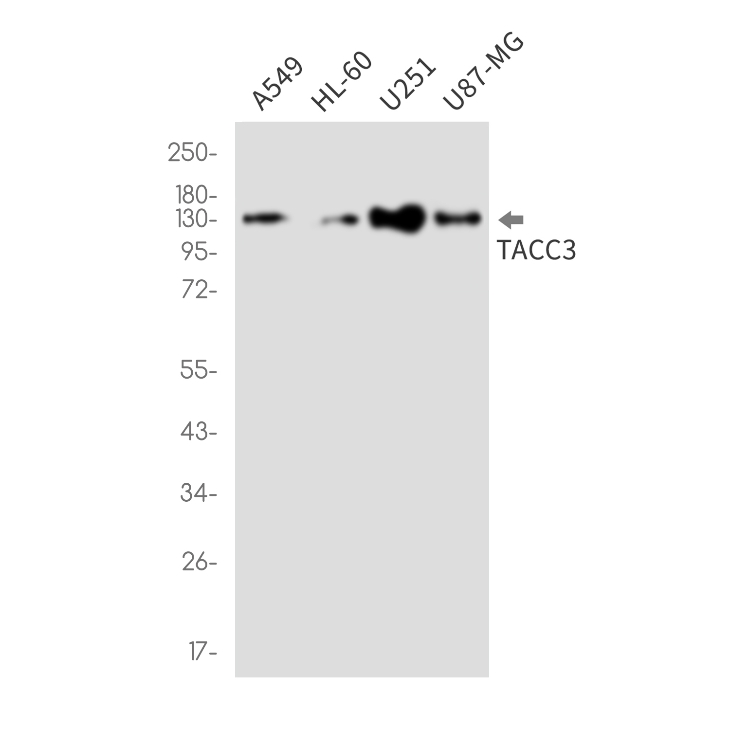 TACC3