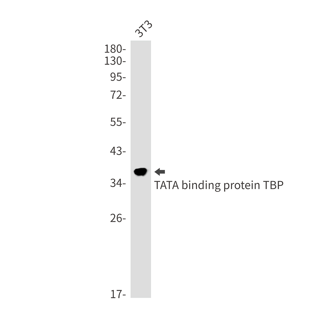 TATA Box Binding Protein