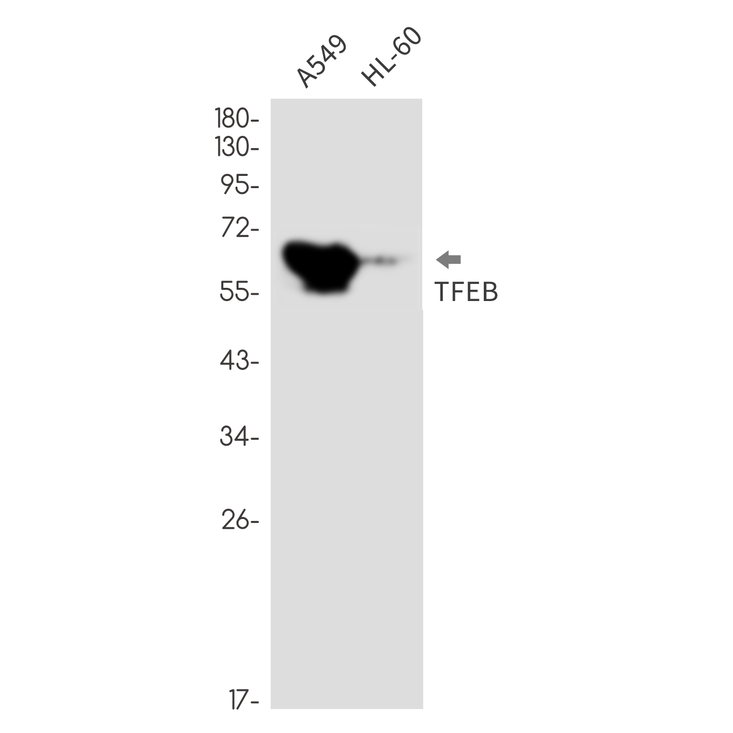Transcription Factor EB