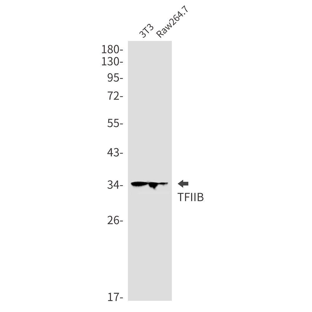 Transcription Initiation Factor IIB