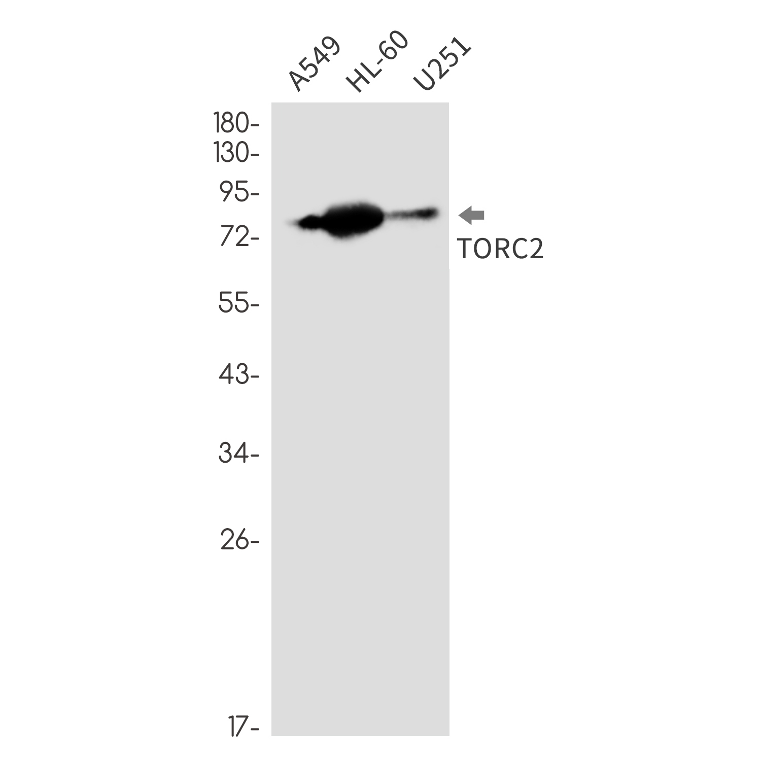 CREB Regulated Transcription Coactivator 2