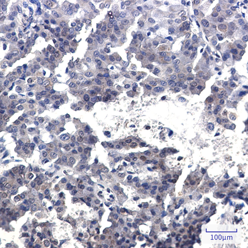 Rabbit Monoclonal Antibody to CREB Regulated Transcription Coactivator 2