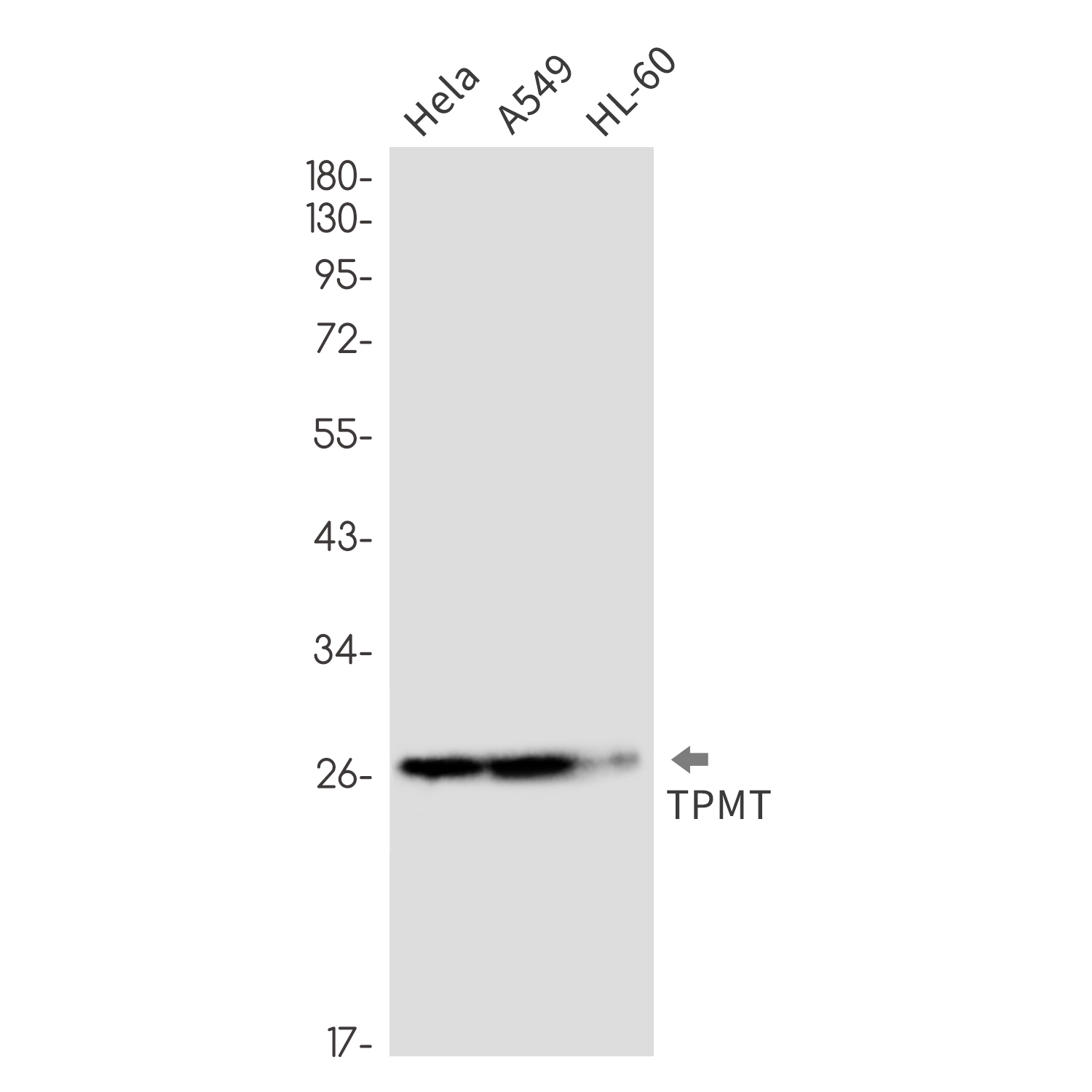 TPMT