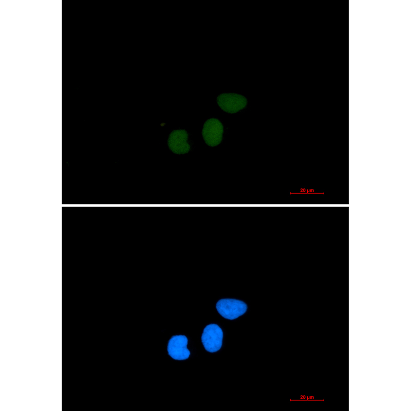 Rabbit Monoclonal Antibody to TPX2