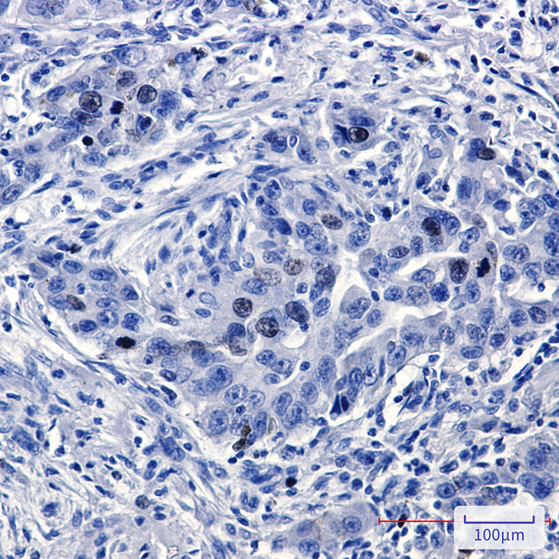 Rabbit Monoclonal Antibody to TPX2