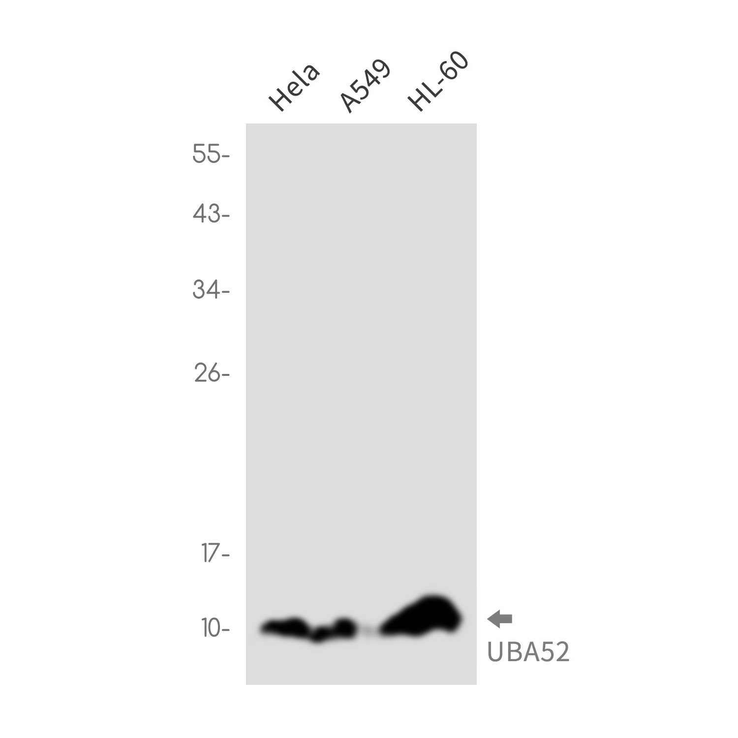 Ubiquitin 60S Ribosomal Protein L40