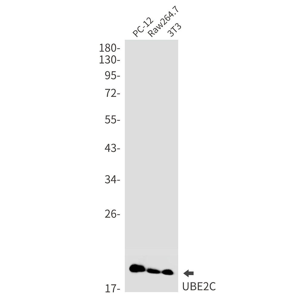 Ubiquitin Conjugating Enzyme E2 C