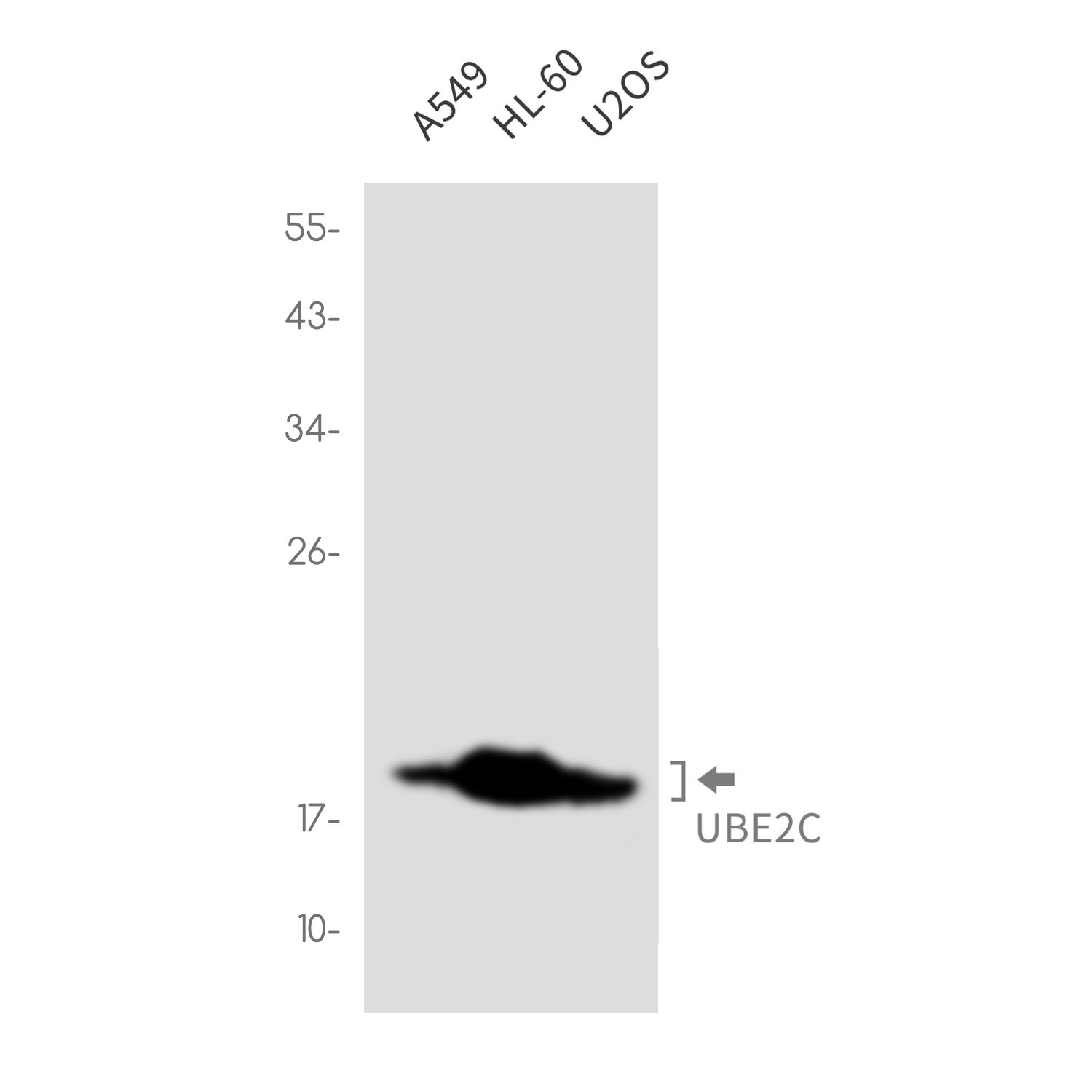 Rabbit Monoclonal Antibody to Ubiquitin Conjugating Enzyme E2 C