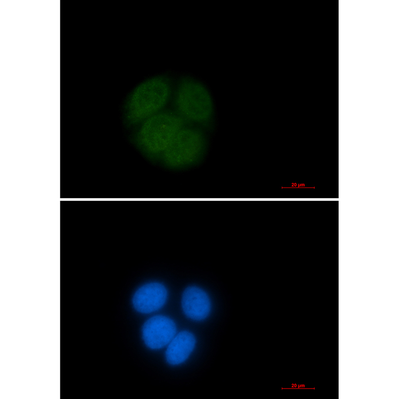 Rabbit Monoclonal Antibody to Ubiquitin Conjugating Enzyme E2 C