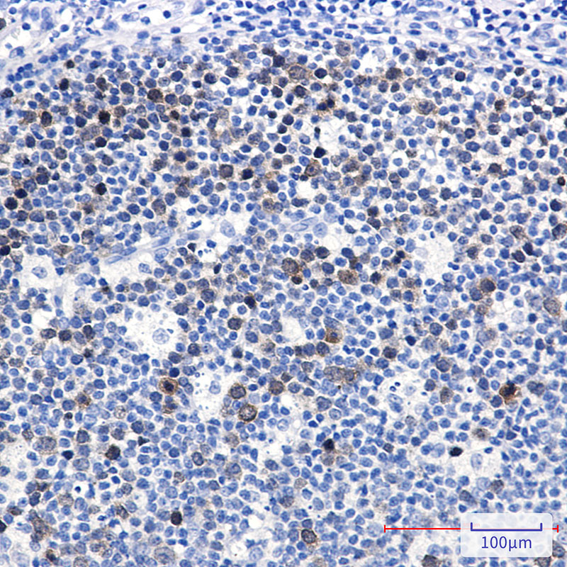 Rabbit Monoclonal Antibody to Ubiquitin Conjugating Enzyme E2 C