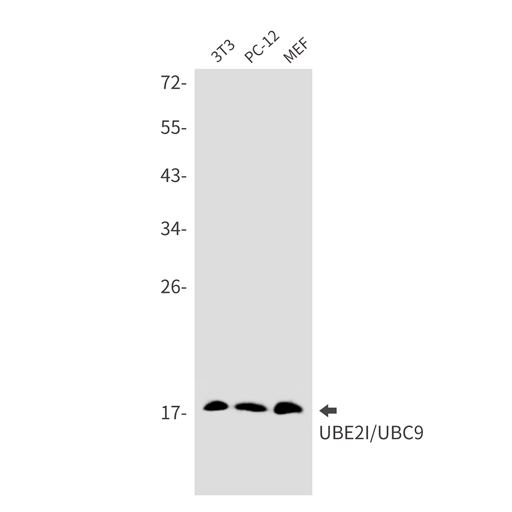 SUMO Conjugating Enzyme UBC9