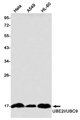 Rabbit Monoclonal Antibody to SUMO Conjugating Enzyme UBC9