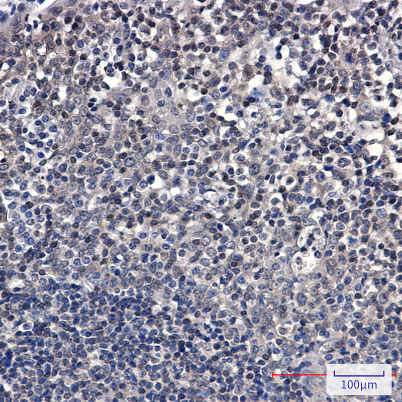 Rabbit Monoclonal Antibody to SUMO Conjugating Enzyme UBC9