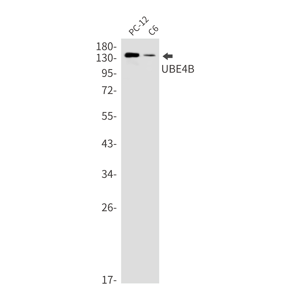Ubiquitin Conjugation Factor E4 B
