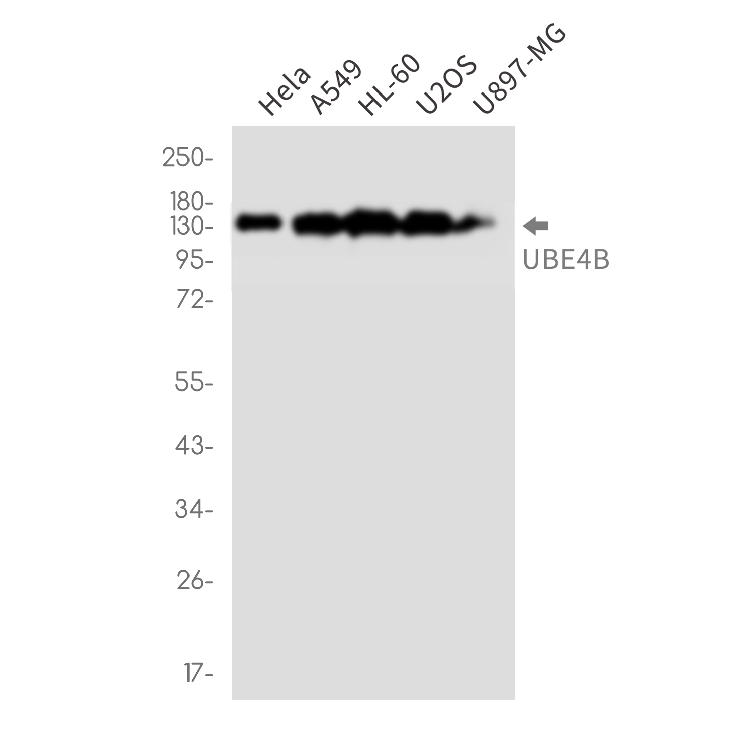 Rabbit Monoclonal Antibody to Ubiquitin Conjugation Factor E4 B