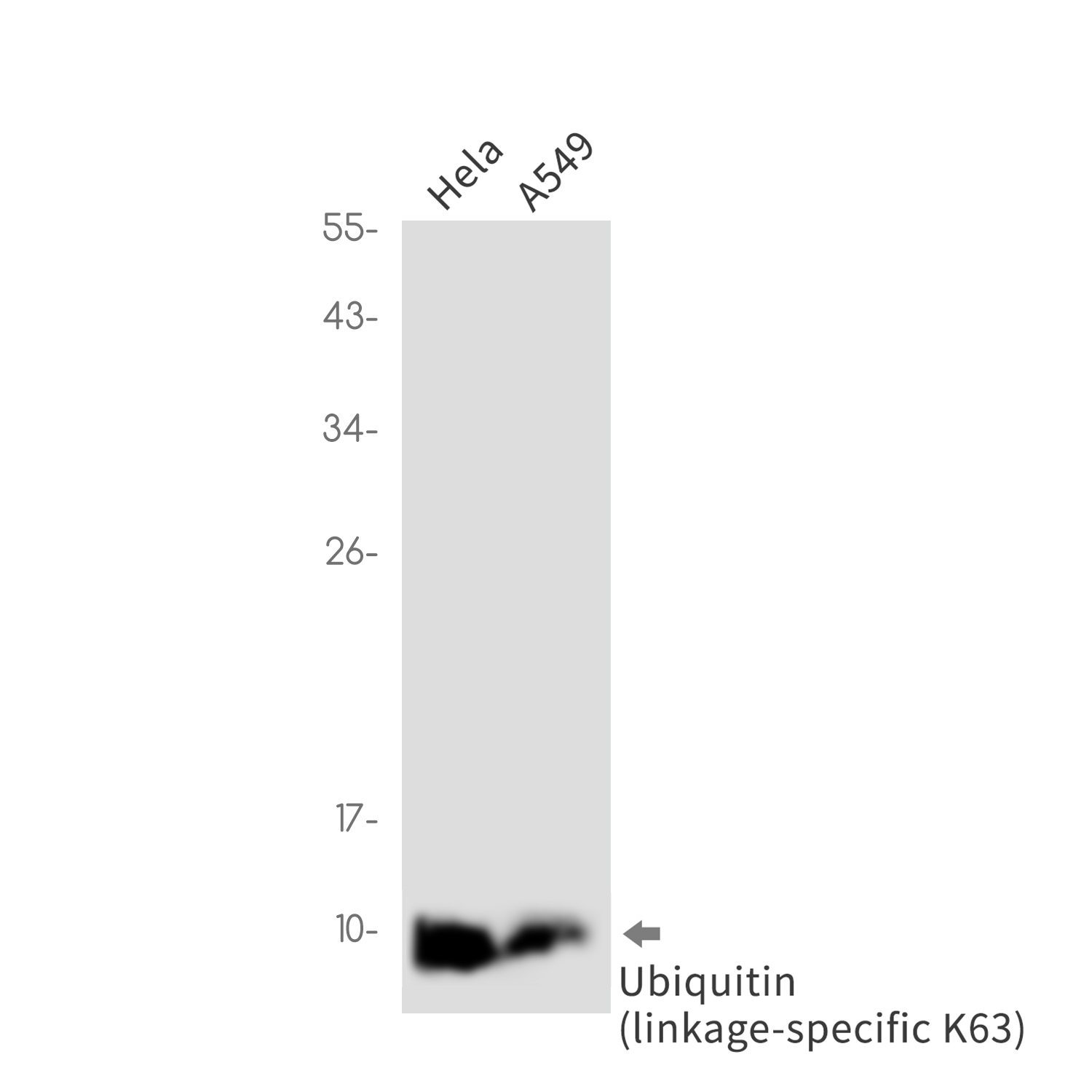 Ubiquitin K63