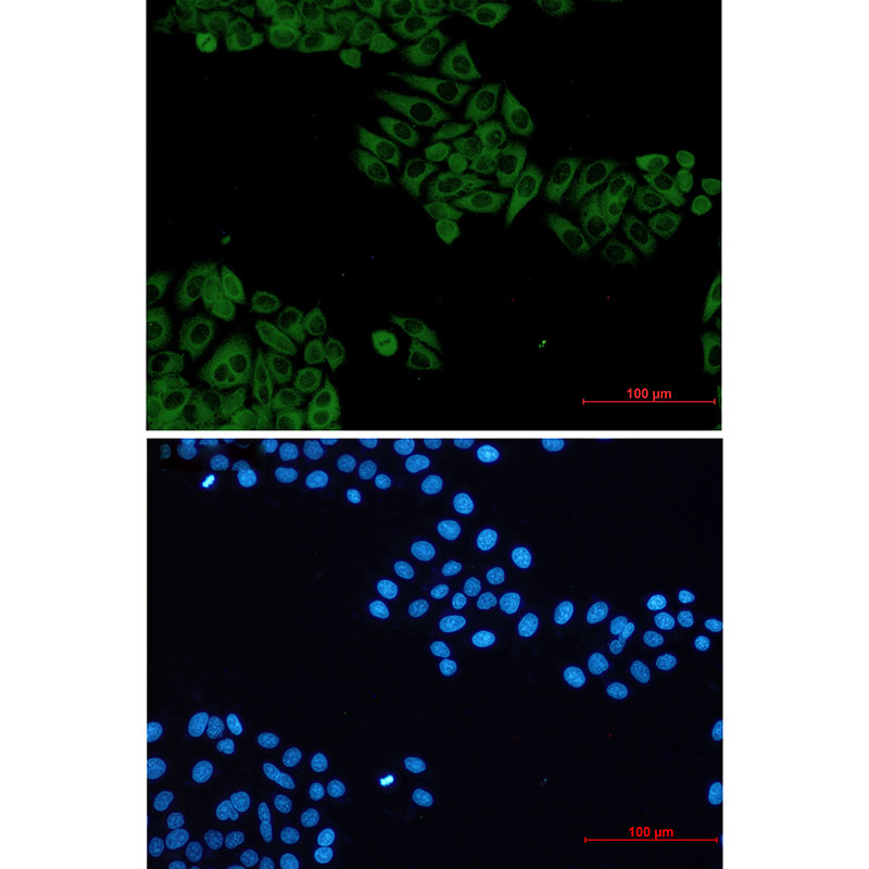 Rabbit Monoclonal Antibody to VAV2