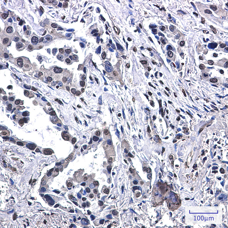 Rabbit Monoclonal Antibody to VPS35