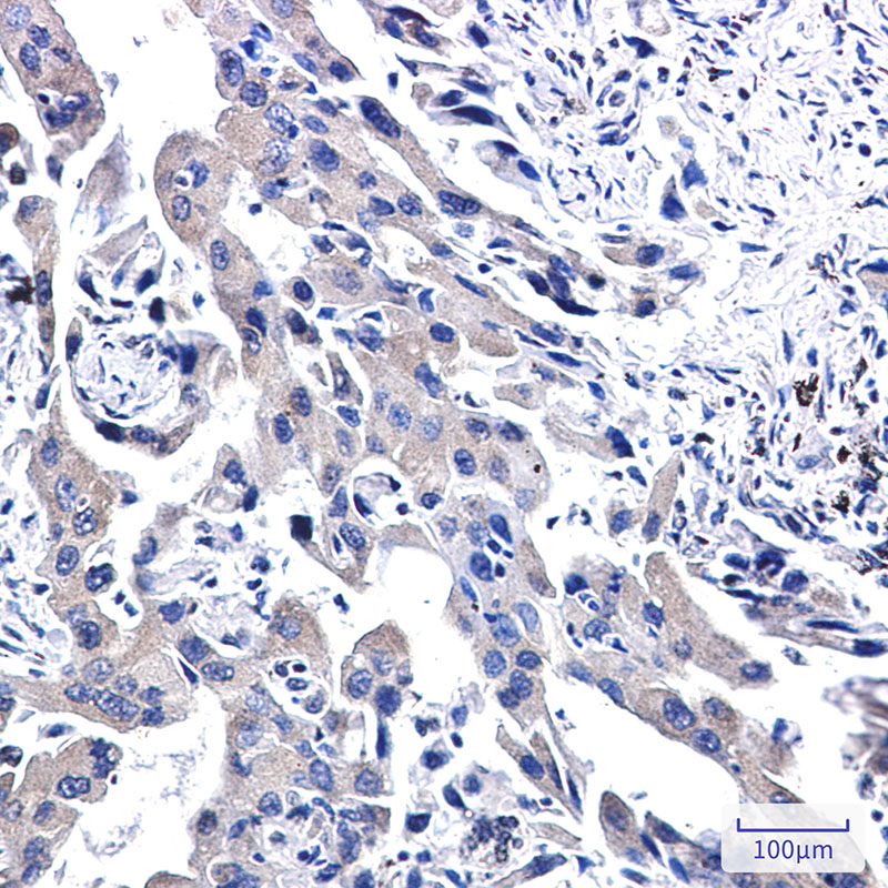 Rabbit Monoclonal Antibody to WWOX