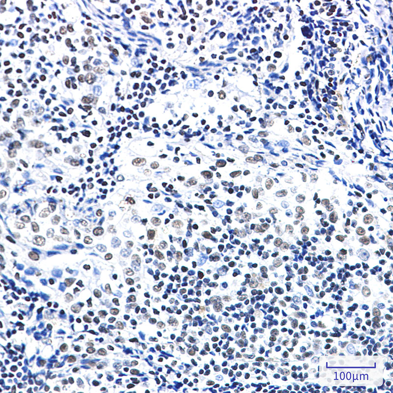 Rabbit Monoclonal Antibody to ZBTB7A