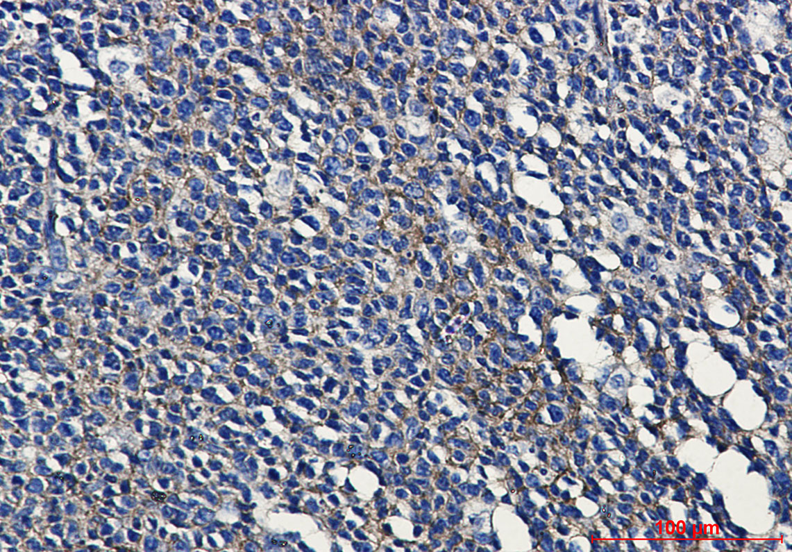 Rabbit Monoclonal Antibody to MHC Class I