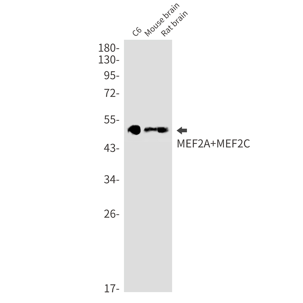 MEF2A/MEF2C