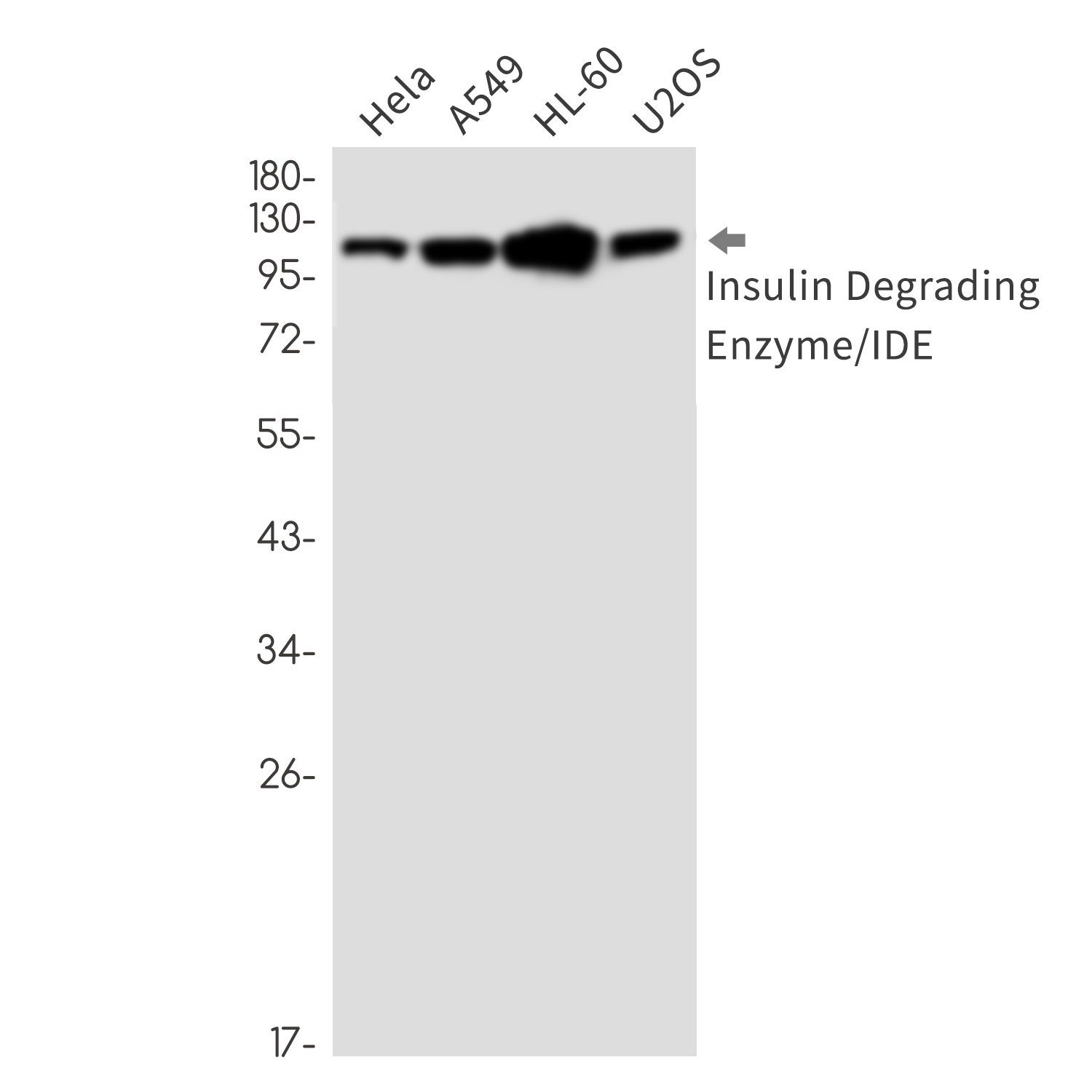 Insulin Degrading Enzyme