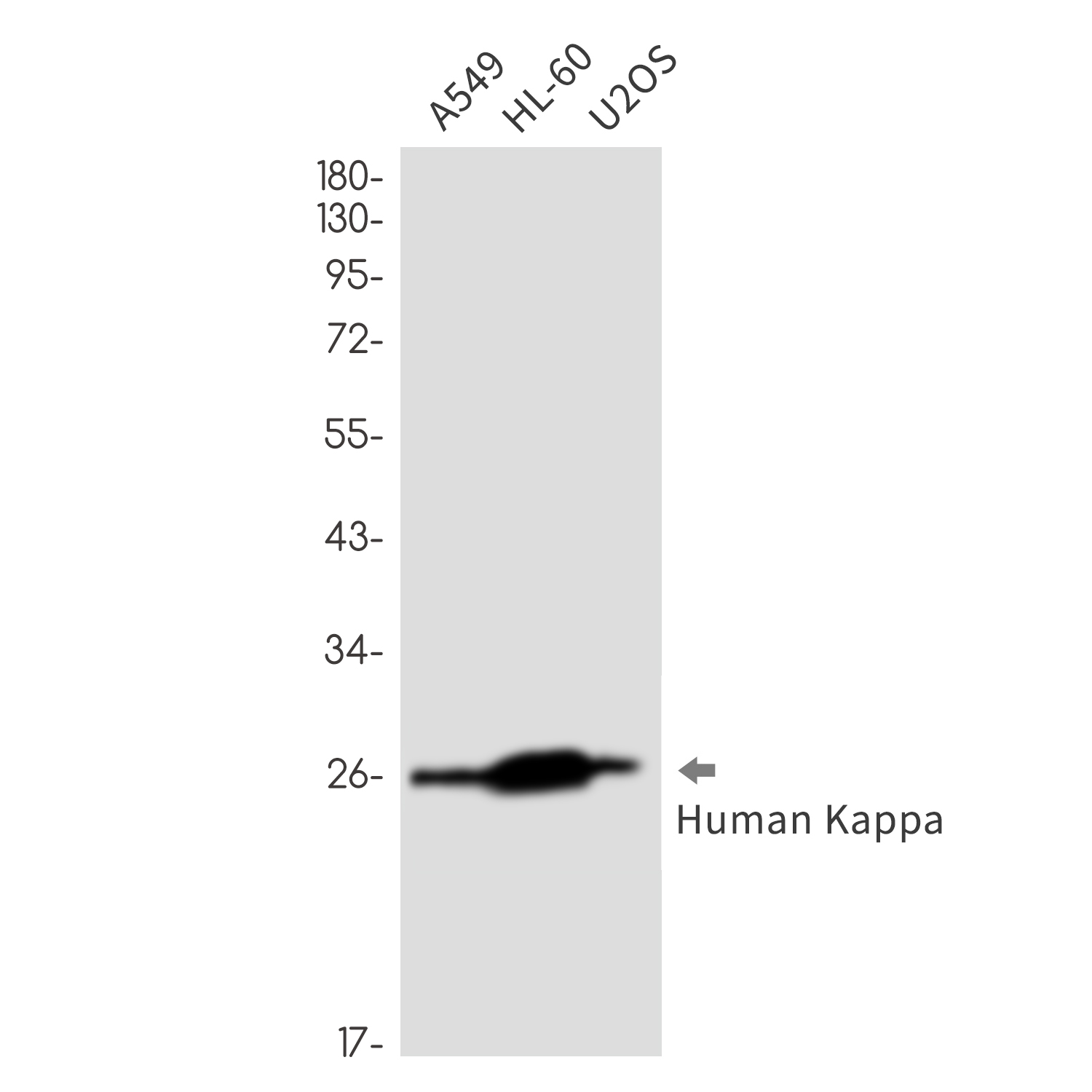 Human kappa Light Chain