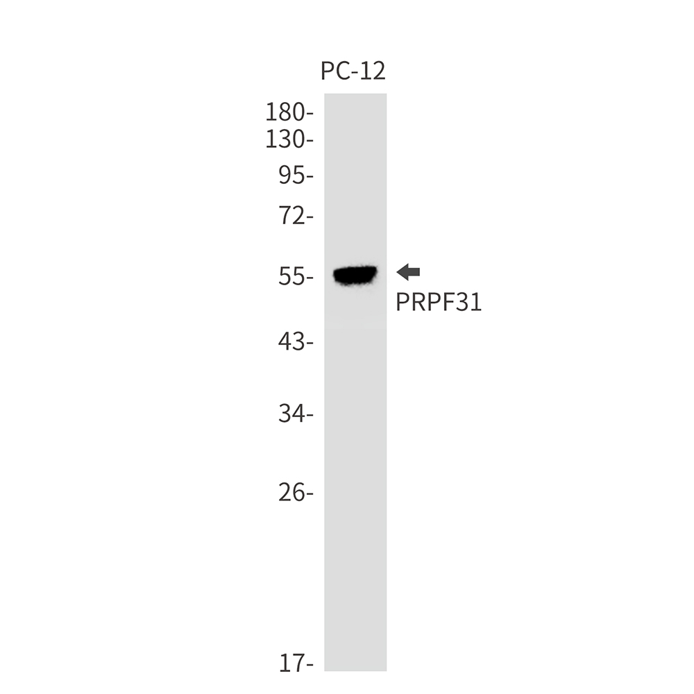 PRPF31