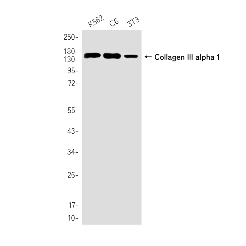 Collagen III alpha 1