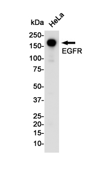 EGFR