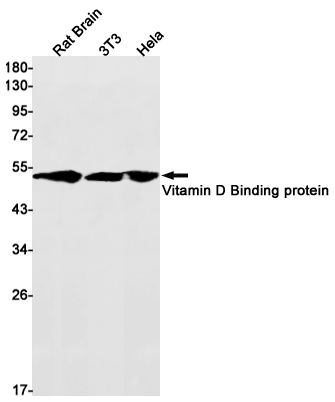 Vitamin D Binding Protein