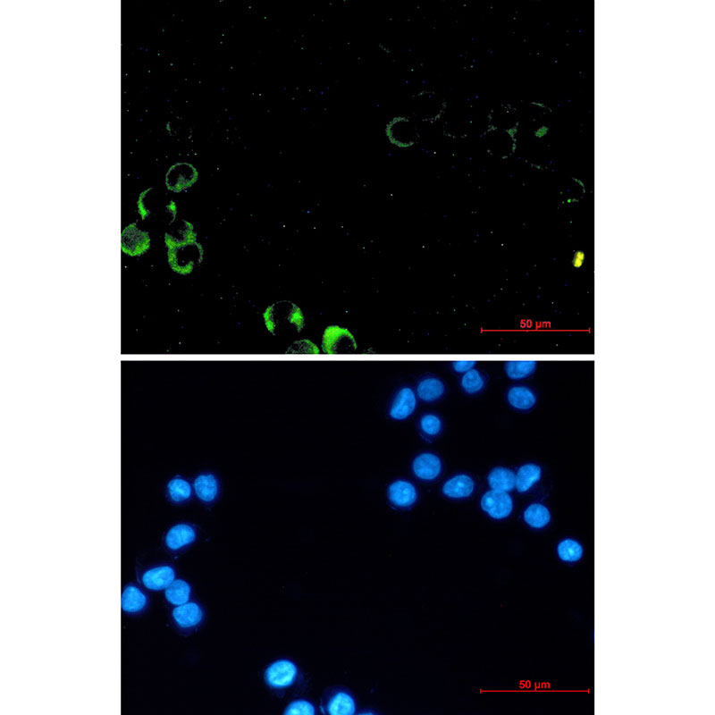 Rabbit Monoclonal Antibody to PI3 Kinase p85 alpha