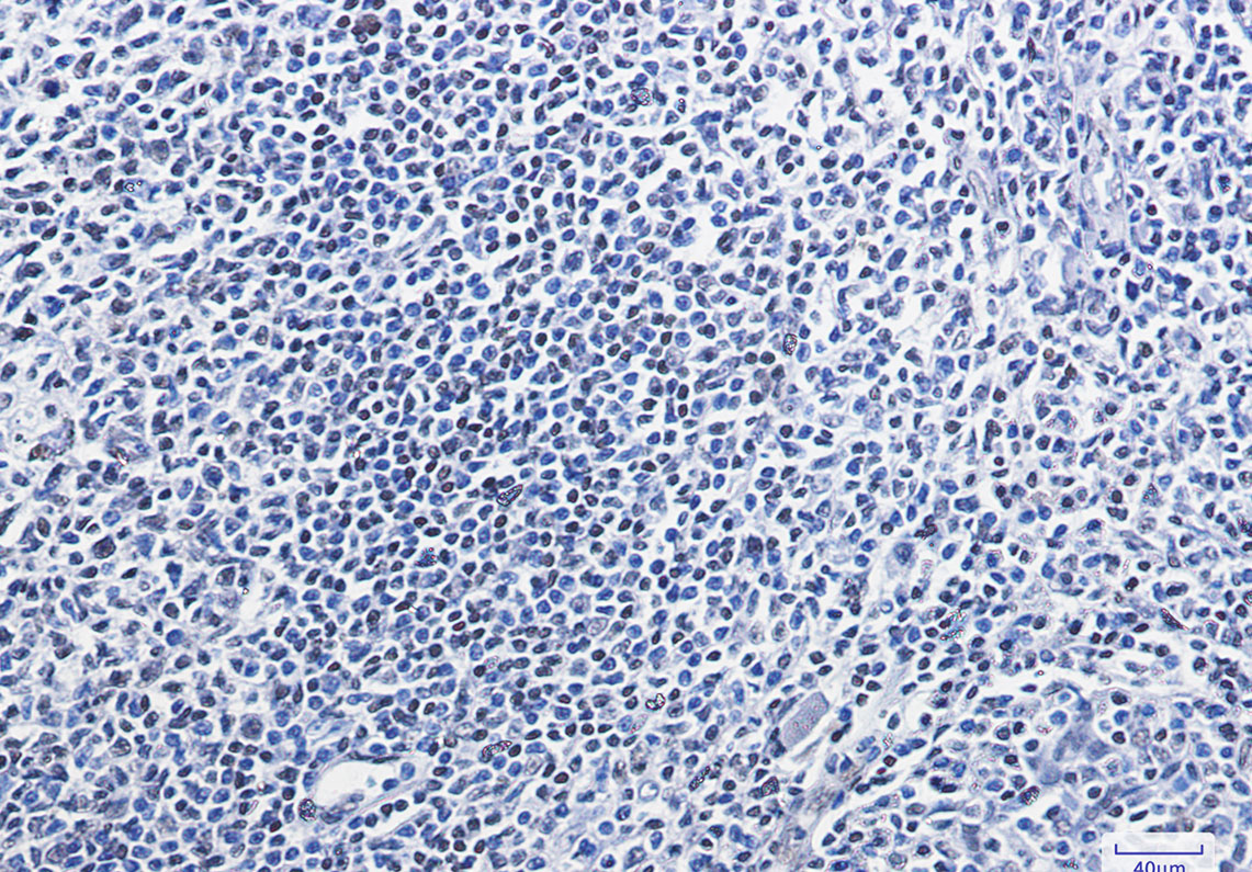 Rabbit Monoclonal Antibody to HMGB1