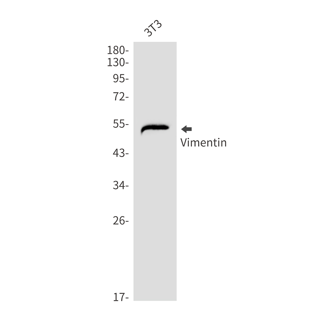 Vimentin