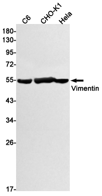 Rabbit Monoclonal Antibody to Vimentin