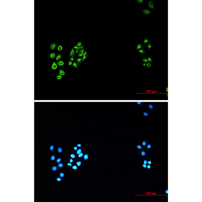 Rabbit Monoclonal Antibody to Vimentin