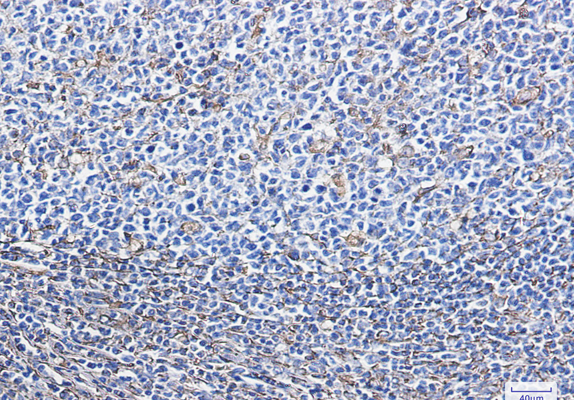 Rabbit Monoclonal Antibody to Vimentin