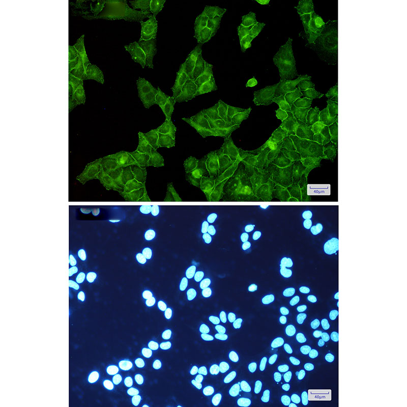 Rabbit Monoclonal Antibody to EGFR