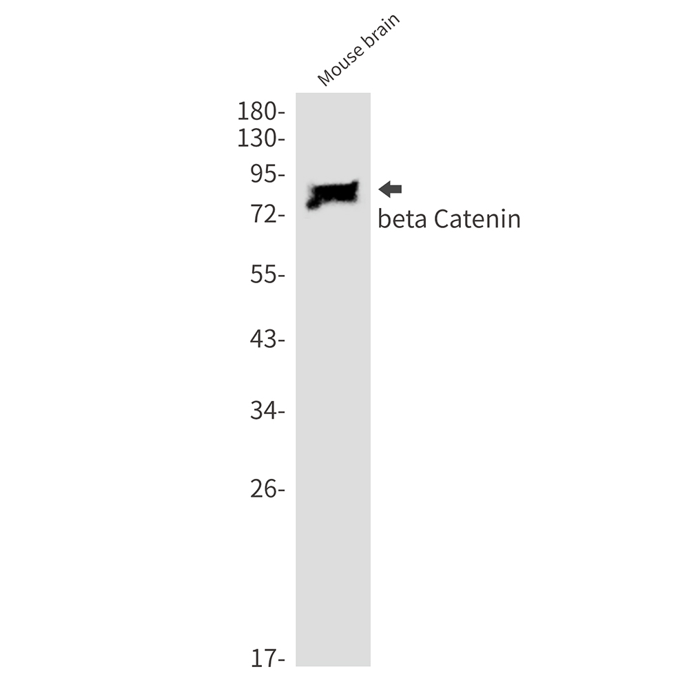 beta Catenin