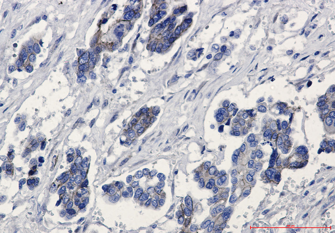 Rabbit Monoclonal Antibody to beta Catenin
