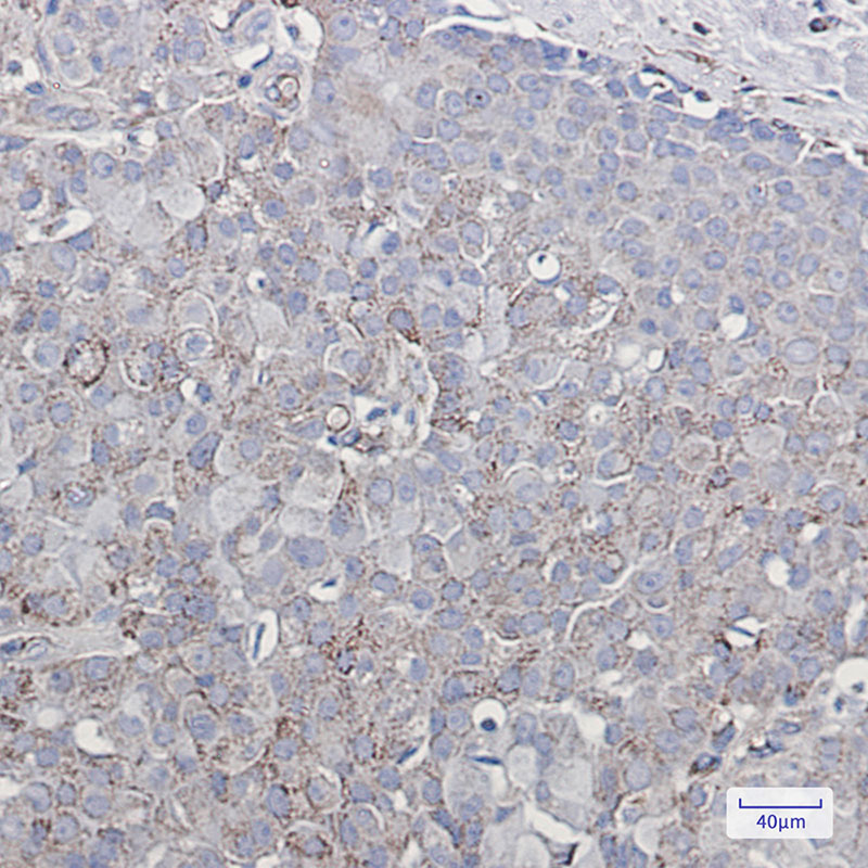 Rabbit Monoclonal Antibody to Ionotropic Glutamate Receptor 2