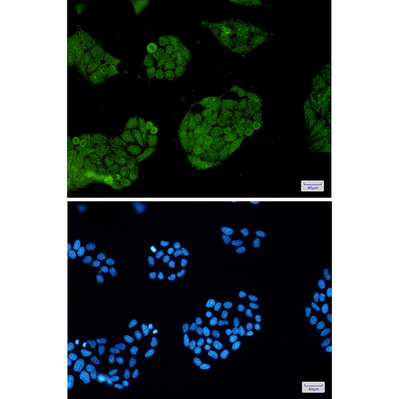 Rabbit Monoclonal Antibody to FOXO1